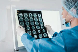 Traumatic Brain Injuries Caused by Car Accidents in South Carolina What You Need to Know